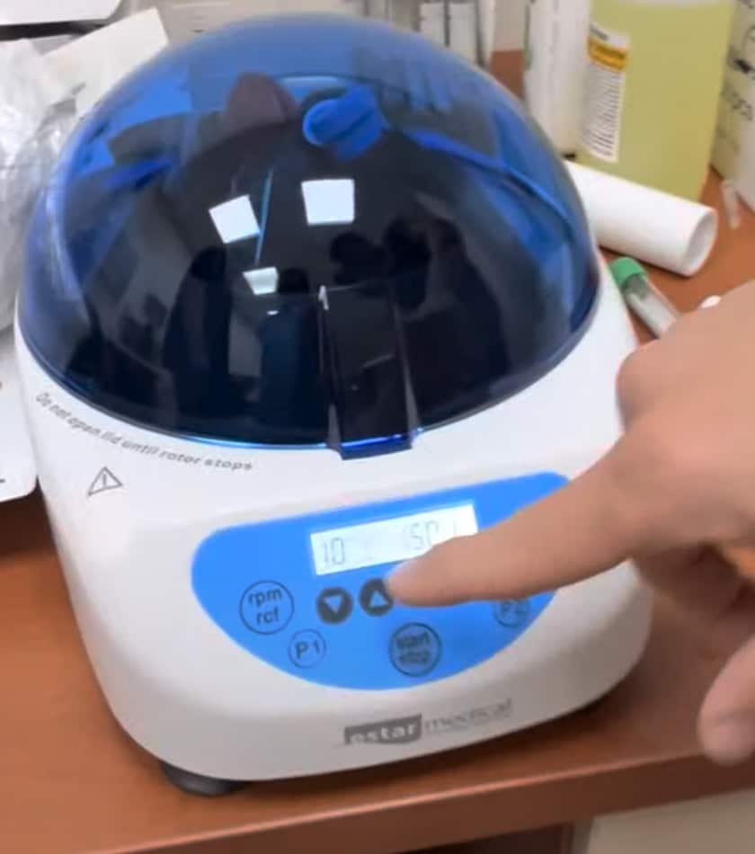 plasma-gel-centrifuge